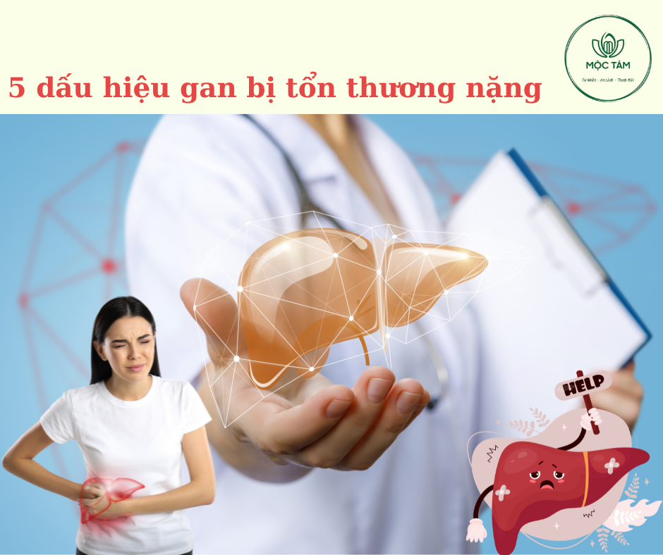 Dấu Hiệu Gan Bị Tổn Thương: 5 Điều Bạn Cần Biết
