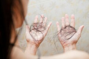 Tóc rụng nhiều nguyên nhân do đâu và cách nhận biết sớm