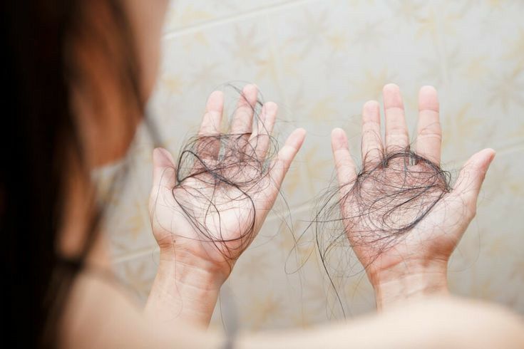 Tóc rụng nhiều nguyên nhân do đâu và cách nhận biết sớm