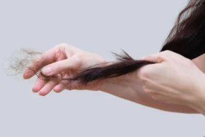 Tóc rụng nhiều ở nữ: Nguyên nhân và cách khắc phục an toàn