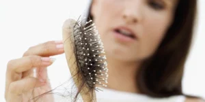 Tóc rụng nhiều bất thường ở nữ: Cảnh báo tình trạng sức khỏe nào?