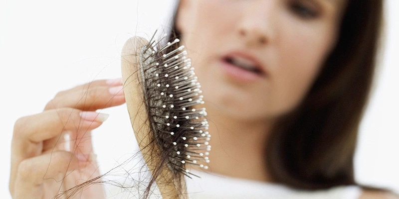Tóc rụng nhiều bất thường ở nữ: Cảnh báo tình trạng sức khỏe nào?
